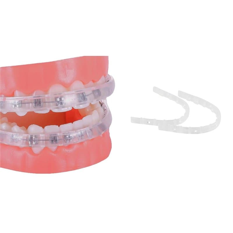 Protège-Lèvres Pour Appareil Dentaire - remplace la Cire Orthodontique - Protège-dents orthodontique pour accolades